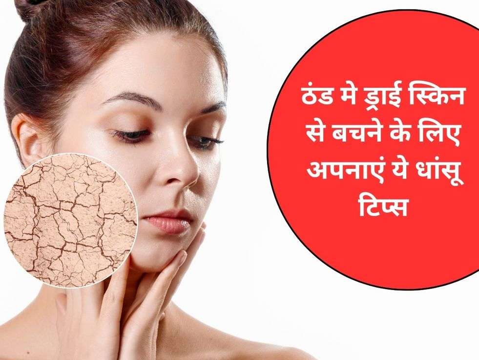 Dry Skin Remedies :ठंड मे ड्राई स्किन से बचने के लिए अपनाएं ये धांसू टिप्स