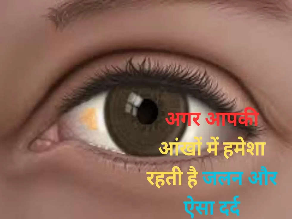 Eye Health Tips: अगर आपकी आंखों में हमेशा रहती है जलन और ऐसा दर्द, हो सकते है इस बीमारी के शिकार, ऐसे करे उपाए...