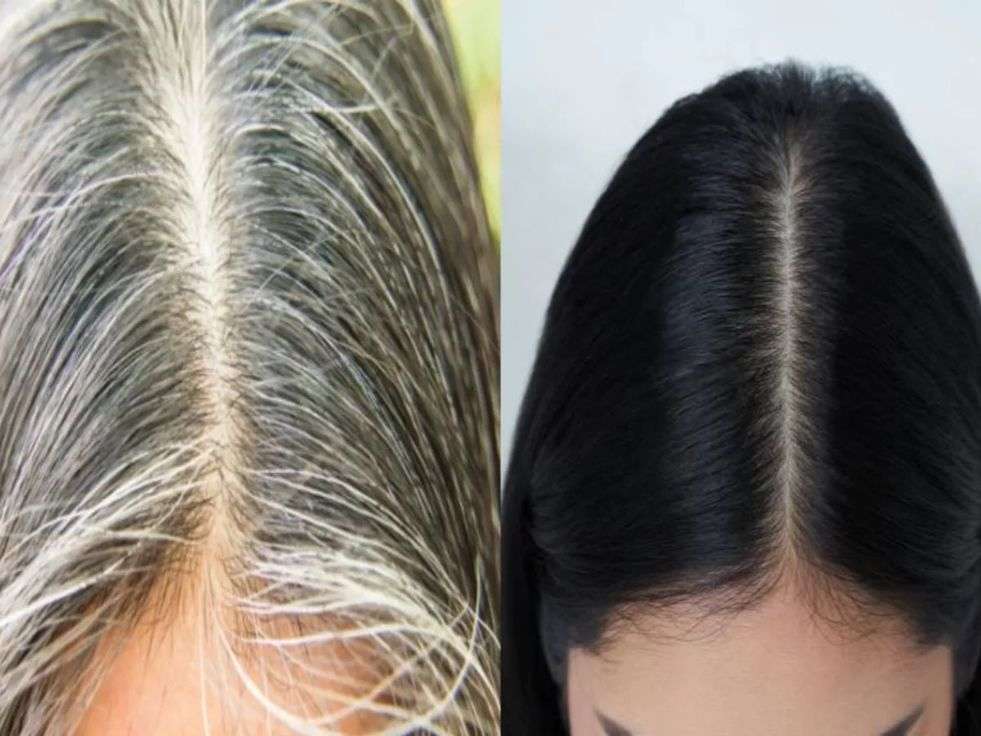 Cloves For Grey Hair: अब सफेद बाल हो जाएंगे काले, मिला अनोखा तरीका, बस ऐसे करें इस्तेमाल