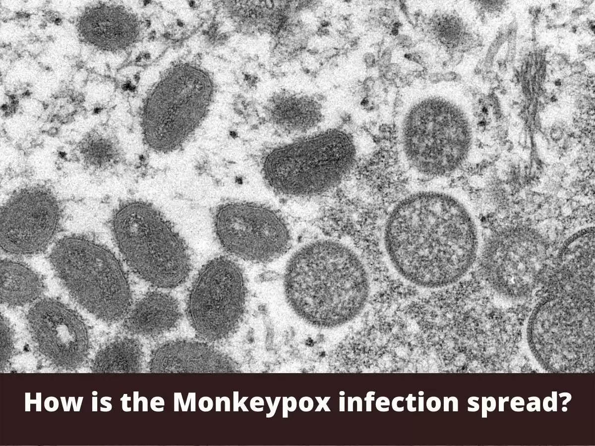 How is the Monkeypox infection spread?