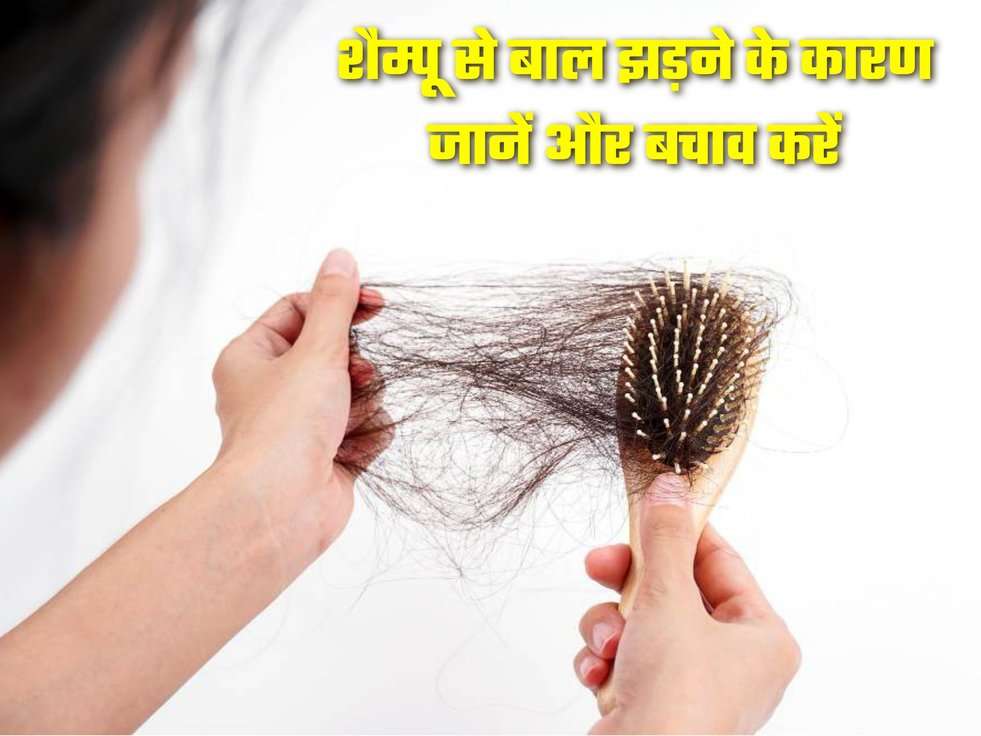 Hairfall