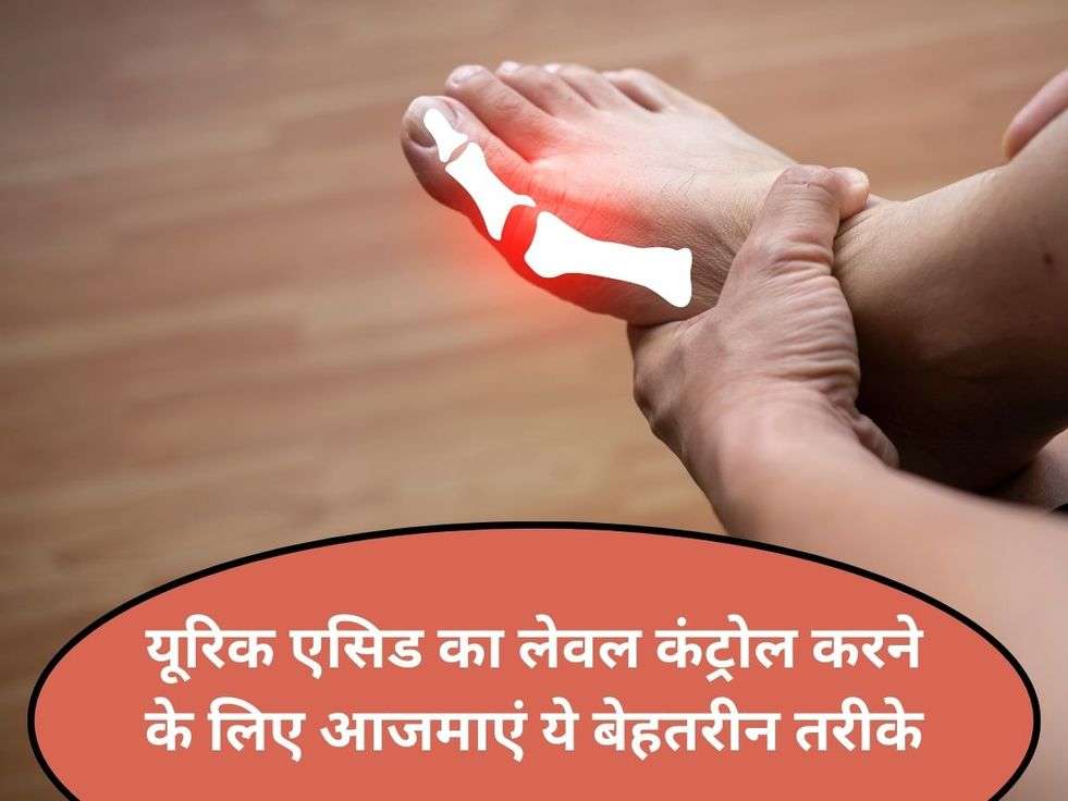 Uric Acid Control Tips : यूरिक एसिड का लेवल कंट्रोल करने के लिए आजमाएं ये बेहतरीन तरीके