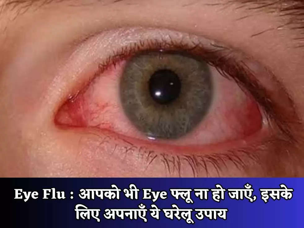 Eye Flu : आपको भी Eye फ्लू ना हो जाएँ, इसके लिए अपनाएँ ये घरेलू उपाय 