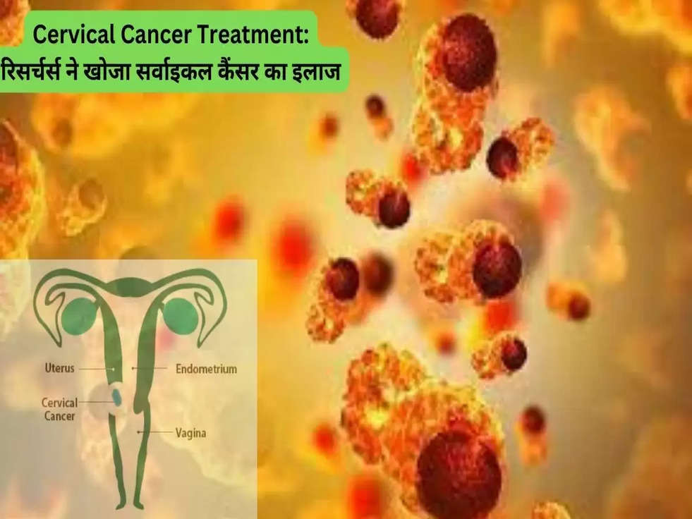 Cervical Cancer Treatment: बीएचयू के रिसर्चर्स ने खोजा सर्वाइकल कैंसर का जबरदस्त इलाज